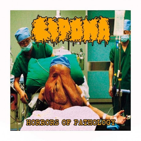 LIPOMA - Horrors of Pathology CD
